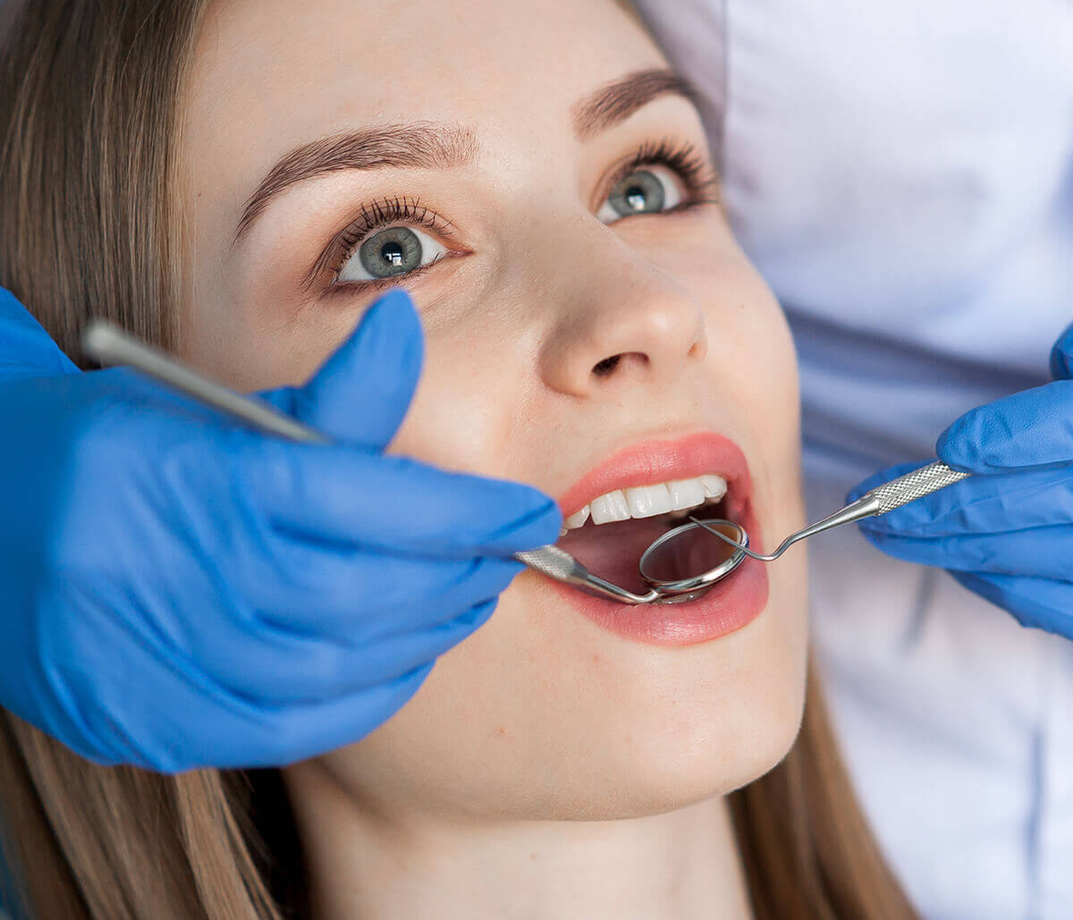 Top Benefits of Choosing Tooth-Colored Fillings for Your Teeth