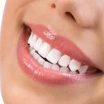 Dental Office Teeth Whitening in Cincinnati OH Area