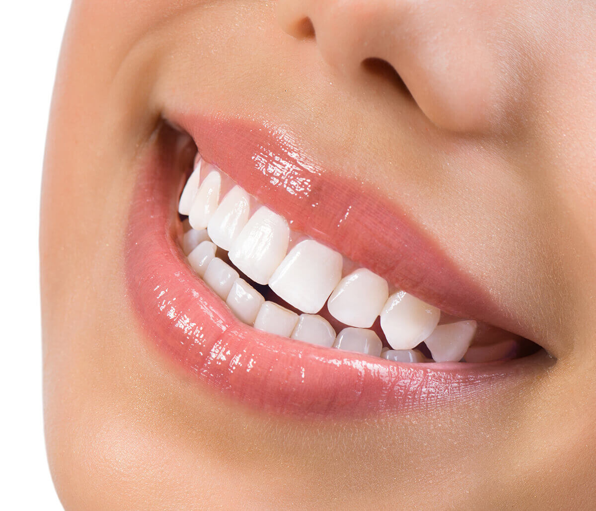 Enhance your smile with Professional Teeth Whitening